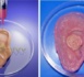 http://www.ndarinfo.com/Des-chercheurs-inventent-une-super-oreille-bionique_a5501.html
