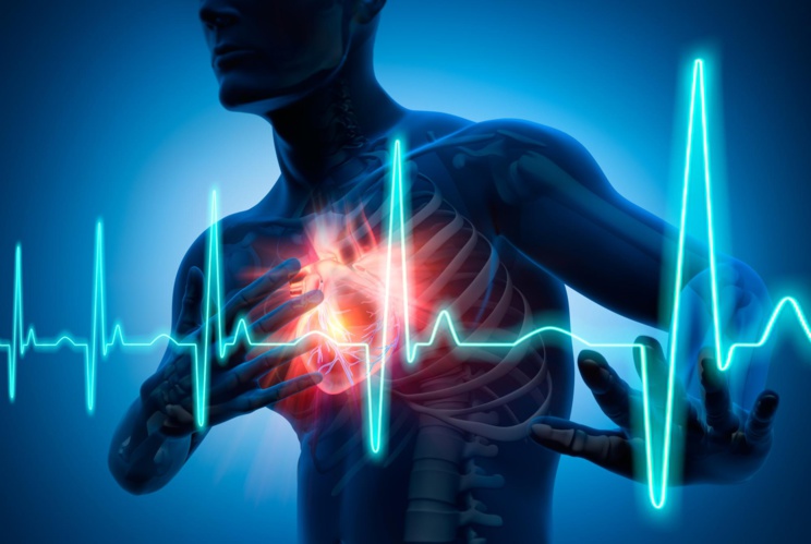 Maladies cardiaques: pourquoi le fléau s'amplifie à Saint-Louis