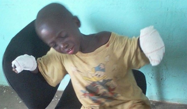 Un père brûle les mains de son fils pour un vol de 350 FCFA à Vavoua Un père brûle les mains de son fils pour un vol de 350 FCFA à Vavoua