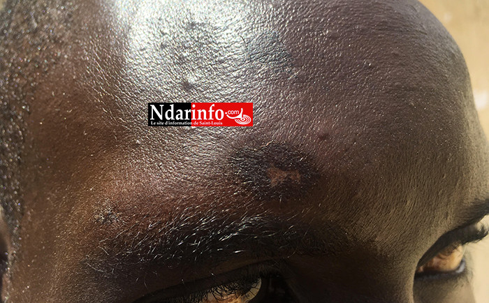 Violence électorale aux Eaux-Claires : injures, coups et blessures. Une plainte en vue contre Mamadou FAYE, le petit frère de Pape Ibrahima FAYE