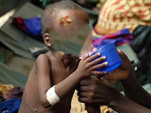 Malnutrition : Saint-Louis, l'une des régions les plus touchées