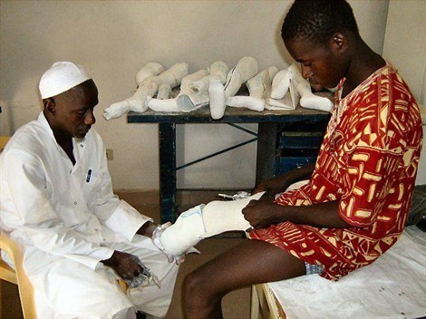 Saint-Louis : 12 enfants déficients moteurs bénéficient d‘opérations de chirurgie orthopédique Saint-Louis : 12 enfants déficients moteurs bénéficient d‘opérations de chirurgie orthopédique