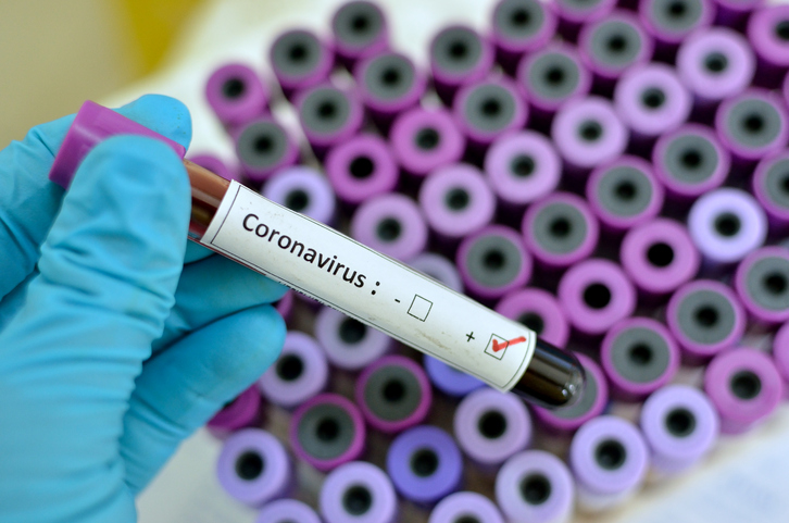 Coronavirus : dix membres d’une même famille infectés à Dakar Coronavirus : dix membres d’une même famille infectés à Dakar