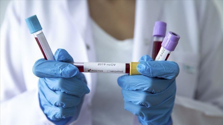 Coronavirus au Sénégal : 12 cas positifs et 6 guéris, ce samedi
