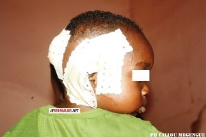 Tentative de mutilation d’un enfant : Atrocités sur Amath Sow
