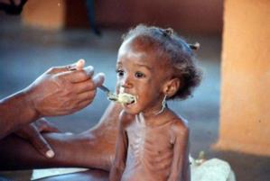 Saint-Louis: Un projet de Plan Sénégal s'engage contre la malnutrition sévère. Saint-Louis: Un projet de Plan Sénégal s'engage contre la malnutrition sévère.
