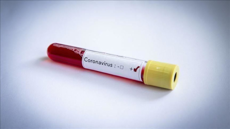 Sénégal : 130 cas positifs au coronavirus, ce matin. 02 nouvelles contaminations à Saint-Louis