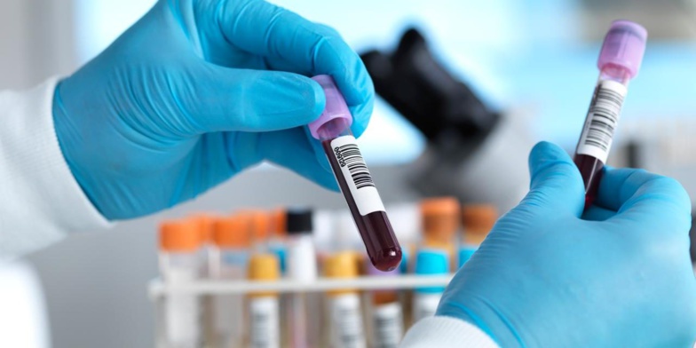 COVID-19 : 41 nouvelles contaminations, 4 décès enregistrés COVID-19 : 41 nouvelles contaminations, 4 décès enregistrés