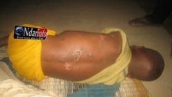 Photo d'un enfant de 5 ans maltraité à St-Louis. Photo d'un enfant de 5 ans maltraité à St-Louis.