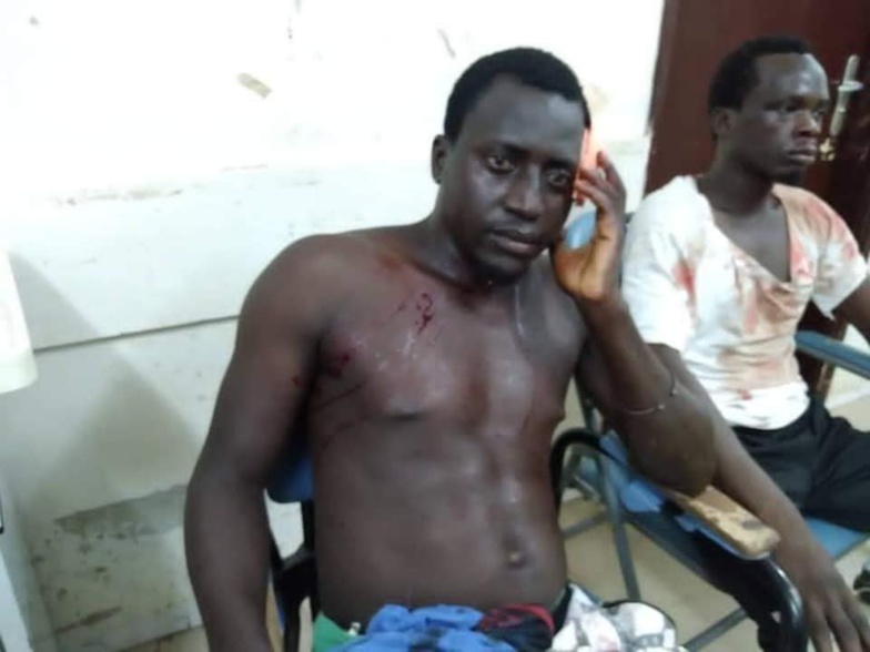 Sonko et Cie attaqués à Ziguinchor : Un responsable de Pastef poignardé. La liste des victimes connue Sonko et Cie attaqués à Ziguinchor : Un responsable de Pastef poignardé. La liste des victimes connue