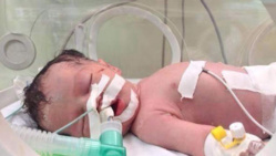 VIDEO - Miracle de la vie à Gaza: un bébé naît 10 minutes après le décès de sa mère