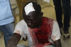Pape Latyr Gueye, étudiant en Master 2 amputé de deux doigts