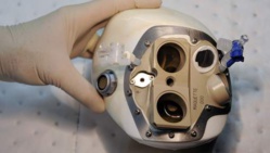 Deuxième implantation d'un coeur artificiel confirmée Deuxième implantation d'un coeur artificiel confirmée