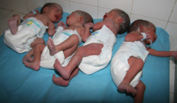Naissance de quadruplés à l'hôpital de Louga