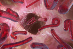 La menace de la propagation de  la fièvre hémorragique à virus Ebola: une opportunité pour le renforcement  du système de santé du Sénégal