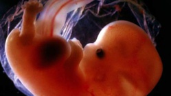 Un foetus momifié dans son corps depuis plus de 50 ans Un foetus momifié dans son corps depuis plus de 50 ans