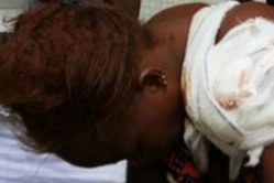 VIOLENCE A NDIOLOFFENE : En colère, un jeune maçon poignarde sa tante. VIOLENCE A NDIOLOFFENE : En colère, un jeune maçon poignarde sa tante.