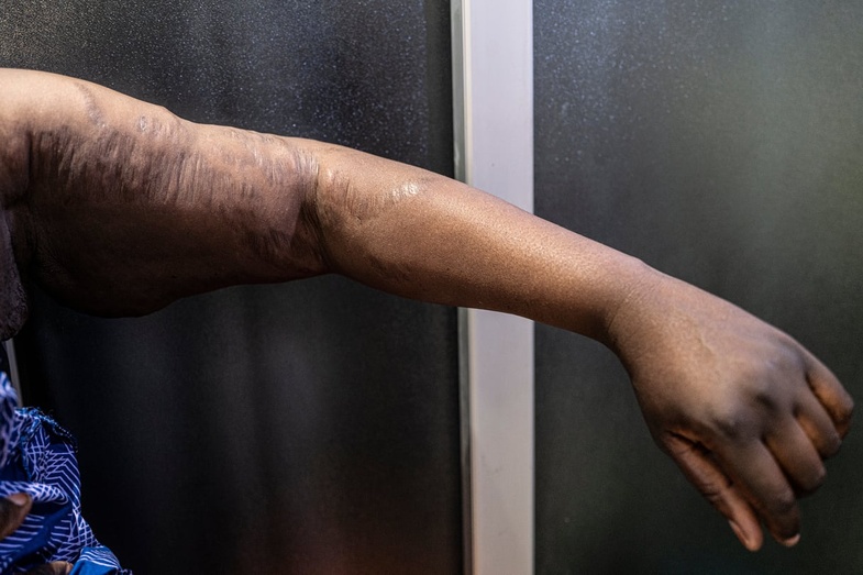 Trafic de produits esthétiques nocifs : trois individus sous les verrous Trafic de produits esthétiques nocifs : trois individus sous les verrous