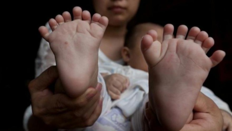 Hong Hong, un petit garçon chinois, est venu au monde avec 15 doigts, 16 orteils et pas de pouce. [Capture d'écran YouTube / @ Yulia Khoma]
