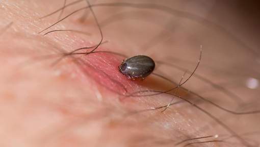 La maladie qui pousse les gens au suicide et dont on parle trop peu La maladie qui pousse les gens au suicide et dont on parle trop peu