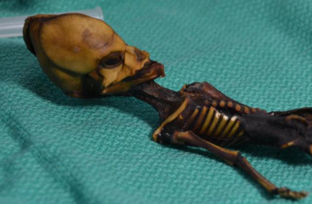 Le squelette d’Atacama faisant penser à un extraterrestre était celui d’une fillette