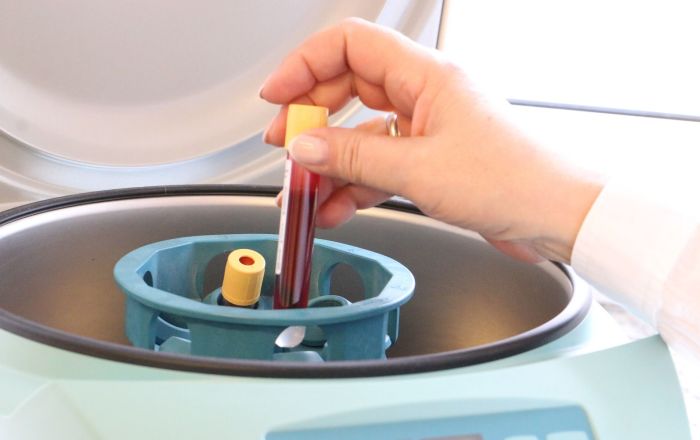 Des chercheurs affirment avoir établi un lien entre un groupe sanguin et le risque d’infection au coronavirus Des chercheurs affirment avoir établi un lien entre un groupe sanguin et le risque d’infection au coronavirus