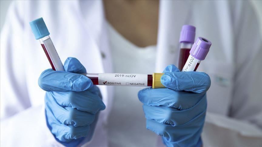 Coronavirus au Sénégal : 12 cas positifs et 6 guéris, ce samedi
