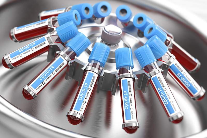 Coronavirus : Au Sénégal, des tests aléatoires à partir de la semaine prochaine