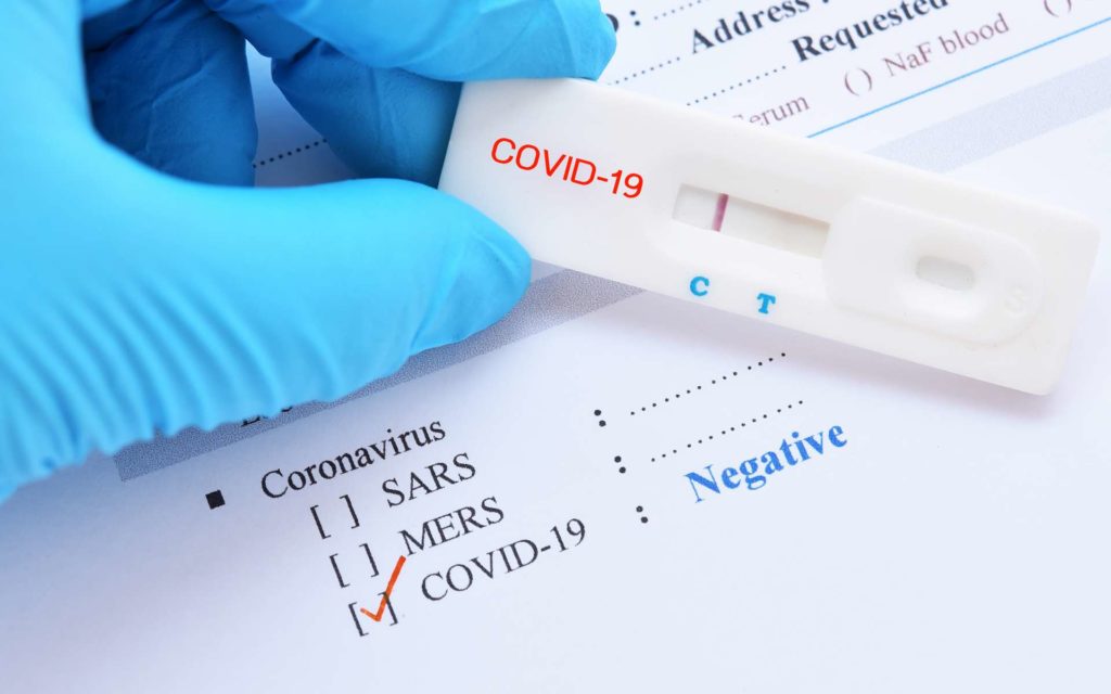 L’agence de l’IPRES du Point E très exposée à la COVID-19 : Treize cas de coronavirus détectés