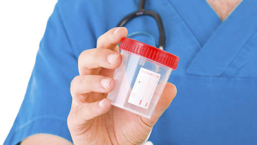 Un test urinaire pour dépister le cancer du col de l'utérus