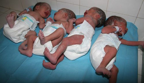 Naissance de quadruplés à l'hôpital de Louga