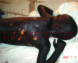 SAINT-LOUIS - POUR AVOIR TORTURE, LIGOTE ET ENCHAINE UN TALIBE: Le maître coranique prend six mois de prison SAINT-LOUIS - POUR AVOIR TORTURE, LIGOTE ET ENCHAINE UN TALIBE: Le maître coranique prend six mois de prison