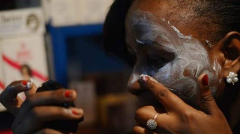 Sénégal : un taux de mortalité alarmant lié à la dépigmentation