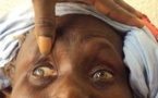 165 mille aveugles et 550 mille malvoyants au Sénégal