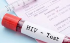 Sénégal : "la prévalence du VIH/SIDA est en train de baisser"