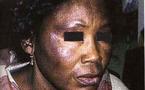 Le ‘’Xessal’’ ou la dépigmentation des femmes sénégalaises: Quels sont les dangers de cette pratique ?
