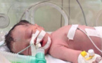 VIDEO - Miracle de la vie à Gaza: un bébé naît 10 minutes après le décès de sa mère