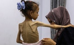 L'ONU déclare officiellement l'état de famine à Gaza, la première à toucher le Moyen-Orient