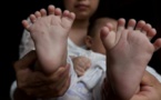 Chine : un bébé naît avec 15 doigts et 16 orteils