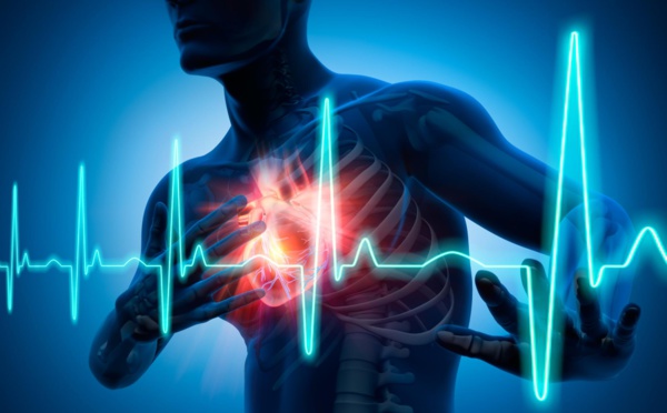 Maladies cardiaques: pourquoi le fléau s'amplifie à Saint-Louis