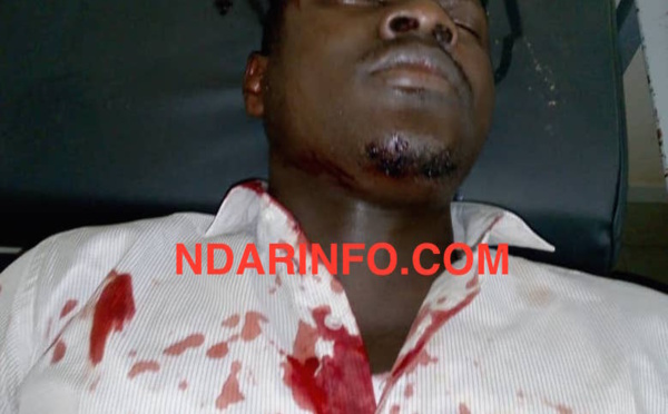 ​Saint-Louis : Une caravane de PASTEF attaquée. Quatre personnes blessées. Les « marrons du feu » indexés (images choquantes  )