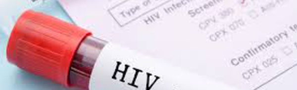 Sénégal : "la prévalence du VIH/SIDA est en train de baisser"