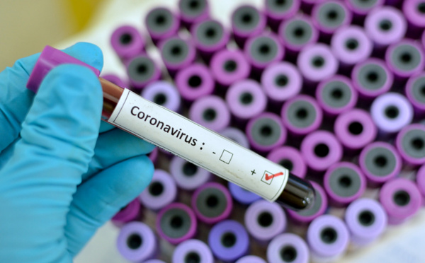 Coronavirus : dix membres d’une même famille infectés à Dakar