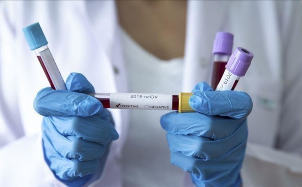 Coronavirus au Sénégal : 12 cas positifs et 6 guéris, ce samedi
