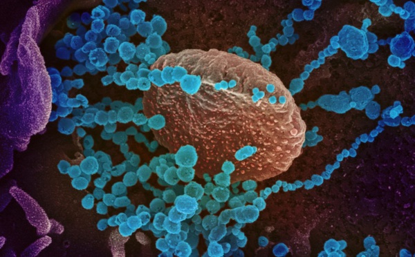 Covid-19 : Dans le portrait du virus, des zones de flou persistent