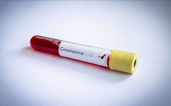 Sénégal : 130 cas positifs au coronavirus, ce matin. 02 nouvelles contaminations à Saint-Louis