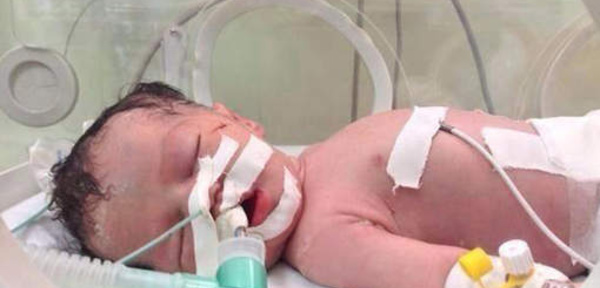 VIDEO - Miracle de la vie à Gaza: un bébé naît 10 minutes après le décès de sa mère