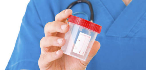 Un test urinaire pour dépister le cancer du col de l'utérus