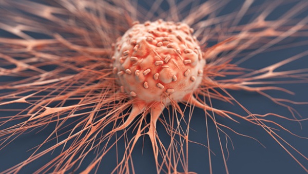 Cancer : 8 mille personnes tuées par an au Sénégal