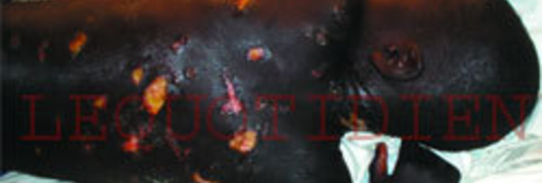 SAINT-LOUIS - POUR AVOIR TORTURE, LIGOTE ET ENCHAINE UN TALIBE: Le maître coranique prend six mois de prison